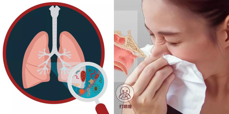 肺炎与鼻炎.png