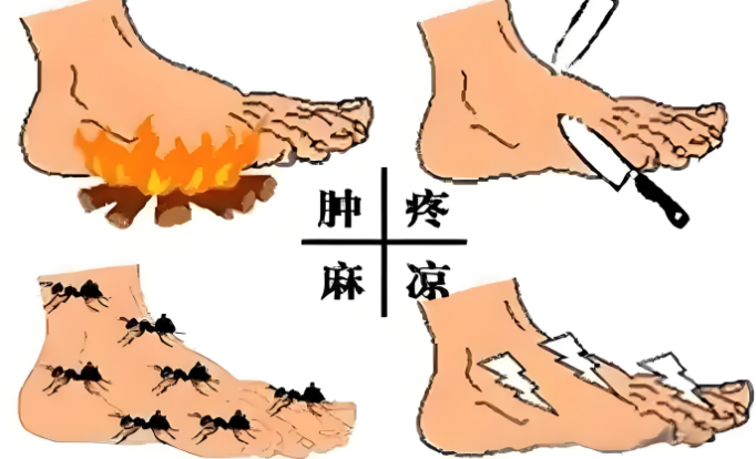 多肽与糖尿病并发症.png