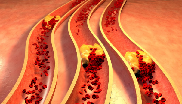 保护血管.png 保护血管.png