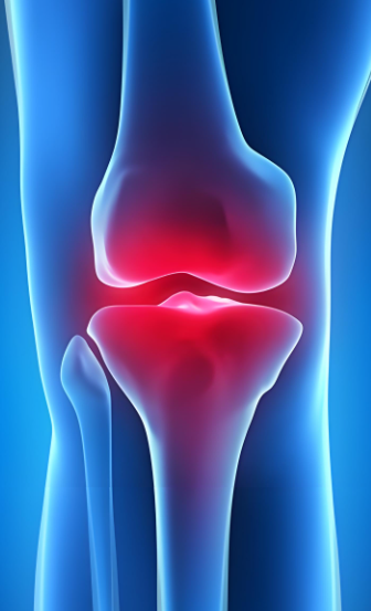 骨关节.png 骨关节.png