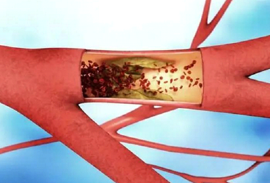 心脑血管2.png 心脑血管2.png