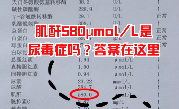 吃什么能降尿肌酐.png