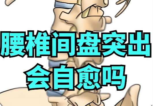 腰椎间盘突出吃什么效果好.png